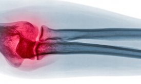 Artroscòpia de colze